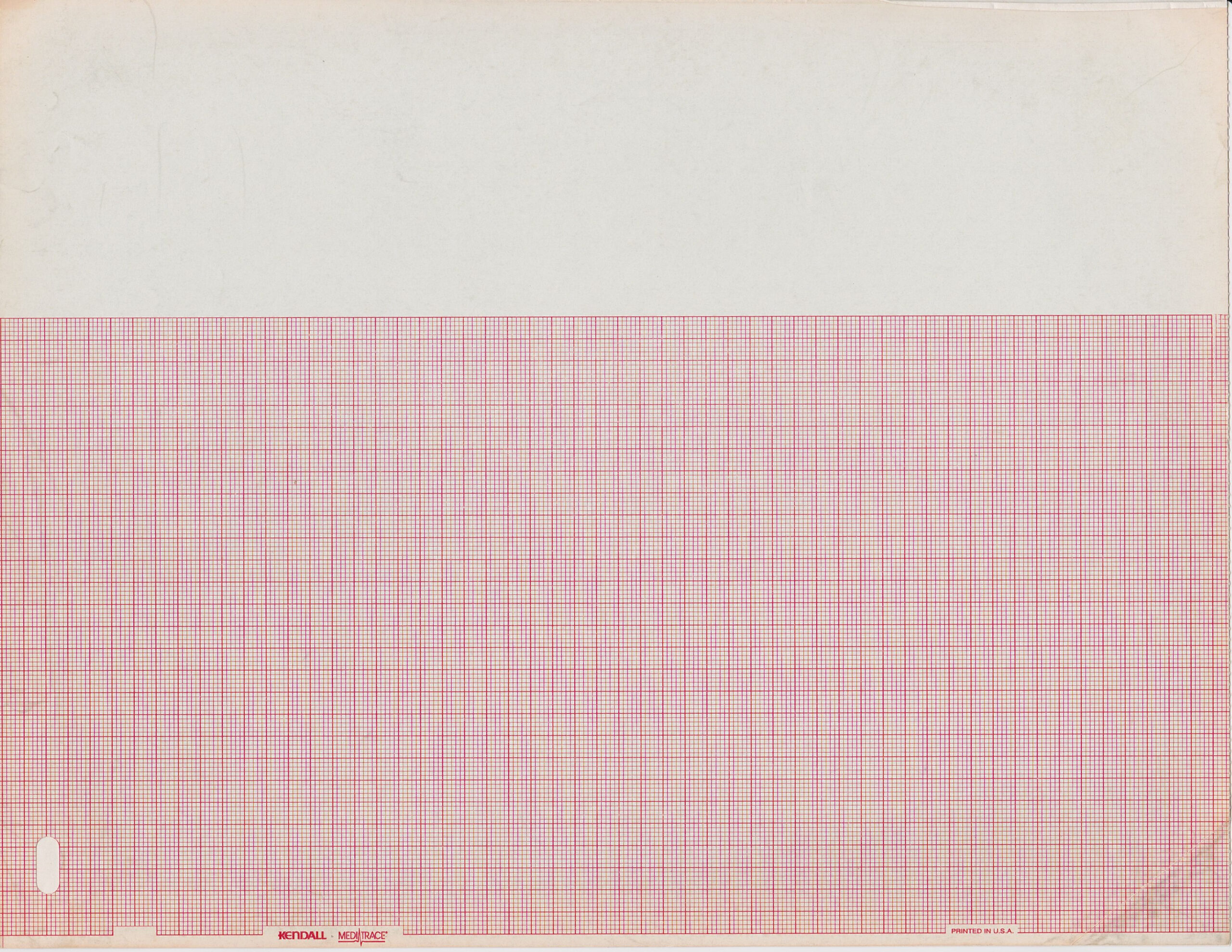 Blank Ecg Paper | Ecg Guru - Instructor Resources in Ekg Paper Printable