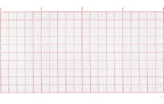 Ecg Paper 57Mm X 35M To Suit Macquarie Ecg Machine (Wslst) - Sss inside Ekg Paper Printable