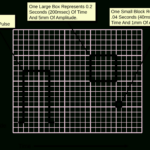 File:ecg Paper.svg   Wikimedia Commons Throughout Ekg Paper Printable