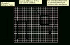 File:ecg Paper.svg - Wikimedia Commons throughout Ekg Paper Printable