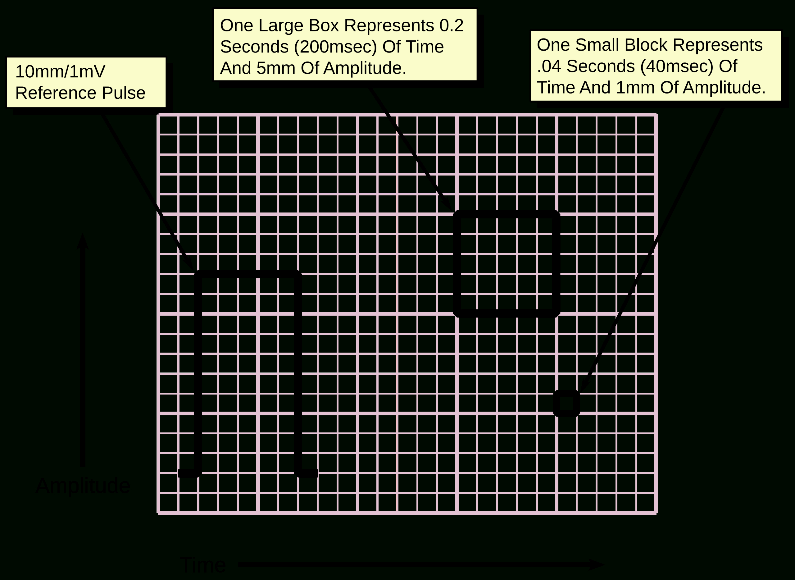 File:ecg Paper.svg - Wikimedia Commons throughout Ekg Paper Printable